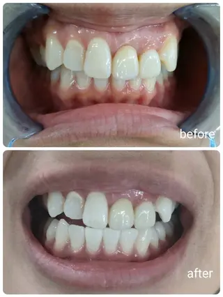 セルフホワイトニング エクシア旭橋店のその他イメージ