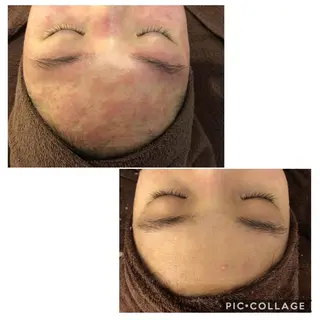 セミロング カラー パーマ ヘアアレンジ メンズ キッズ ネイル マツエク・マツパ 金の糸脱毛 産毛ケア専門のエステ・リラクイメージ