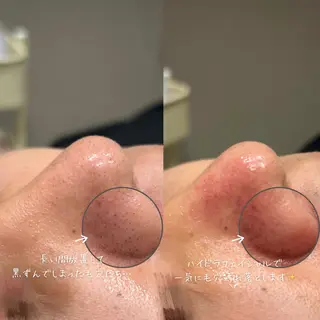 LUMIERE(ルミエル)福岡春吉店所属・LUMIERE 福岡のエステ・リラクイメージ