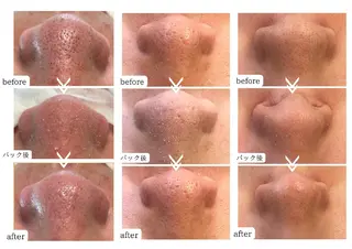 Hisui 種村のエステ・リラクイメージ