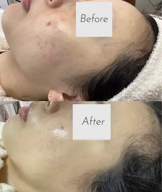 都度払い 肌質改善専門サロンのエステ・リラクイメージ