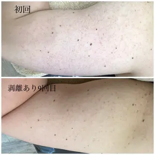 ハーブピーリング専門 エミルカ船橋のエステ・リラクイメージ