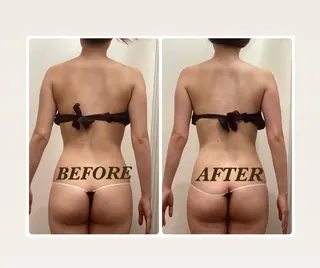 Prima 痩身脱毛 にごうかおりのエステ・リラクイメージ