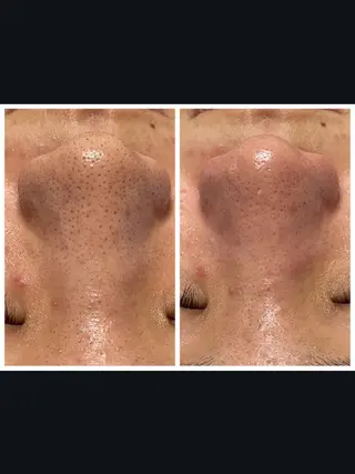 Abe Yukaのエステ・リラクイメージ