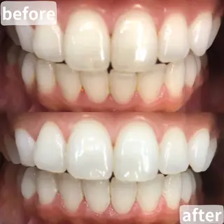 LBSホワイトニング 桶川店のエステ・リラクイメージ