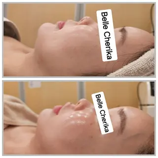 ベル チェリカ 三城のエステ・リラクイメージ