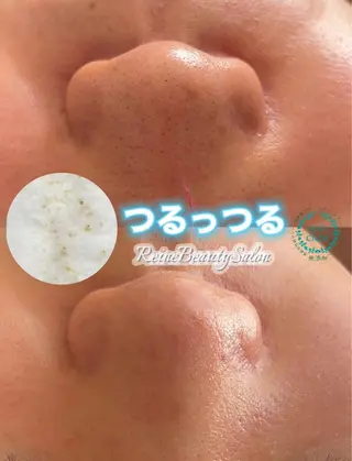 毛穴/シミ肝斑/脱毛 横山梨里のエステ・リラクイメージ