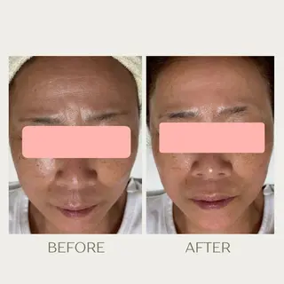 ピーリングケア 🤍moekoのその他イメージ