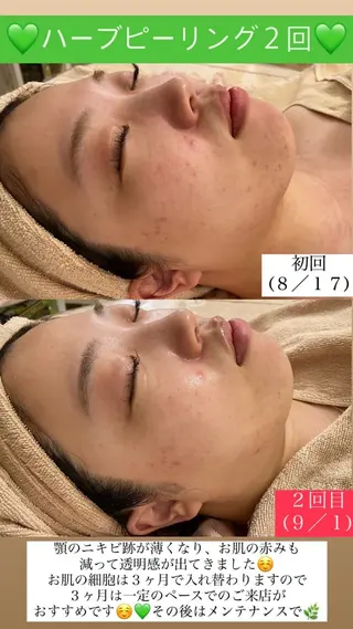 メンズ Salon de Lino 御器所のエステ・リラクイメージ