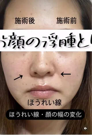 ilima NARUMIのエステ・リラクイメージ