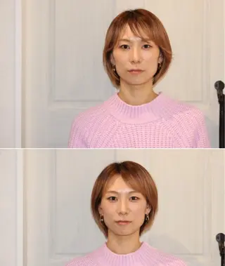 小顔矯/美容鍼/鍼灸 BeauJuのその他イメージ