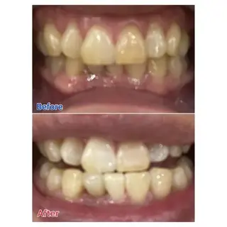 M渋谷 ホワイトニングのエステ・リラクイメージ