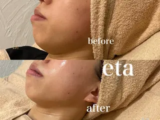 マツエク・マツパ 💋美ボディサロン eta【エタ】💋のエステ・リラクイメージ