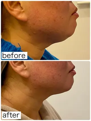 Hisui 小出のエステ・リラクイメージ