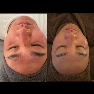 beauty lanaのエステ・リラクイメージ