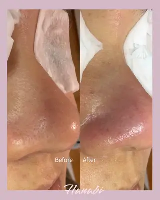 毛穴専門サロン Hanabiのエステ・リラクイメージ