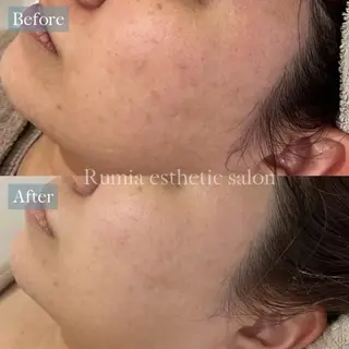 Rumia Salonのエステ・リラクイメージ