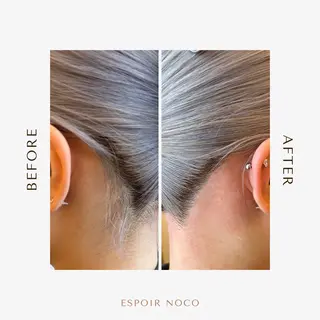 ワックス脱毛🌈 ESPOIRnocoのエステ・リラクイメージ