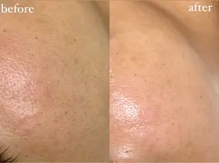 女性専門お顔剃り sunraineのエステ・リラクイメージ