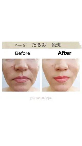 体質改善✨美肌育サロ ン 香嬉琉🌿きよかのエステ・リラクイメージ