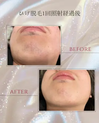 DISINI  SPA所属・DISINISPA 脱毛/フェイシャルのエステ・リラクイメージ