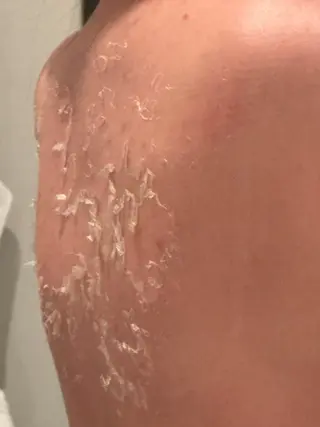 美肌ケアサロン iru【アイル】のエステ・リラクイメージ