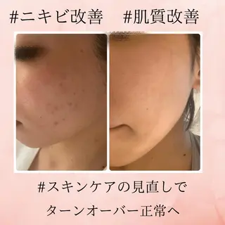 リラクゼーションエステサロン🌺肌質改善イアリイ所属・肌質再生 〜イア🌺リイ〜のエステ・リラクイメージ