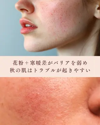 💎ボディエステ＆ 脱毛＆スパ💎山岡のエステ・リラクイメージ