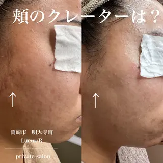 大久保 里奈のエステ・リラクイメージ