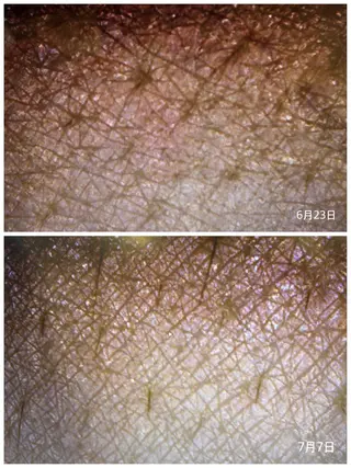 肌質改善サロン🫧 MAIのエステ・リラクイメージ