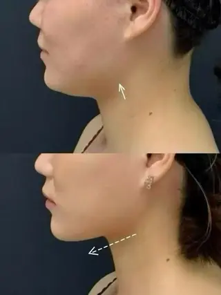 マツエク・マツパ aliaハーブ水光店 エステティシャン募集のエステ・リラクイメージ