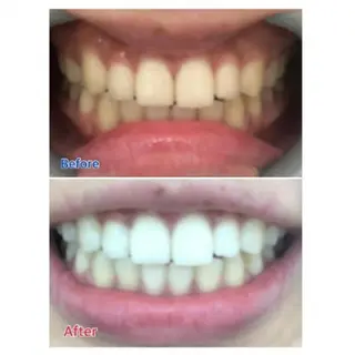 Ｍ渋谷 ホワイトニングのエステ・リラクイメージ