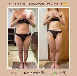 《本気痩せ×疲労改善 》  BILOOPのエステ・リラクイメージ
