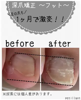 ネイル nail salon petillantのネイルデザイン