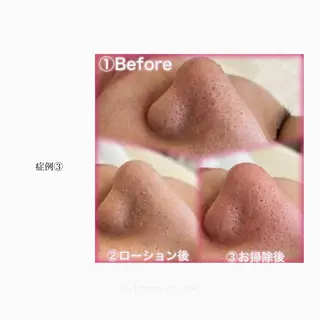 La beauté et santé岡崎店所属・望月 はるかのエステ・リラクイメージ