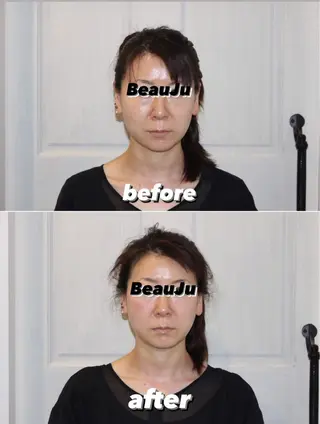 小顔矯/美容鍼/鍼灸 BeauJuのその他イメージ