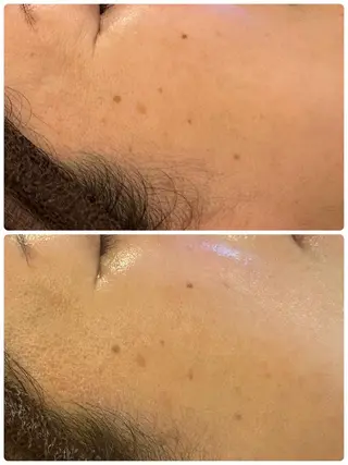 LILY Eのエステ・リラクイメージ