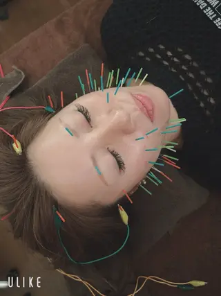 美容鍼灸サロン YOSHINOのエステ・リラクイメージ