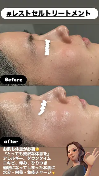 LiZA エステティックサロンのエステ・リラクイメージ