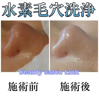 beauty salon  link所属・水素エステと美容脱毛 salon Linkのエステ・リラクイメージ