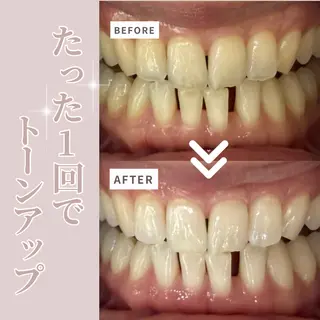 LIBRA自由が丘 ホワイトニングのその他イメージ