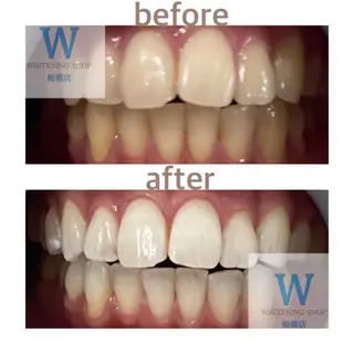 ホワイトニング ショップ船橋店🦷のエステ・リラクイメージ