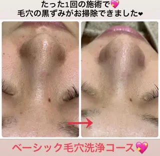 肌質再生 〜イア🌺リイ〜のエステ・リラクイメージ