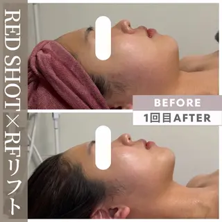 小顔矯正専門店 【RED】池田のエステ・リラクイメージ