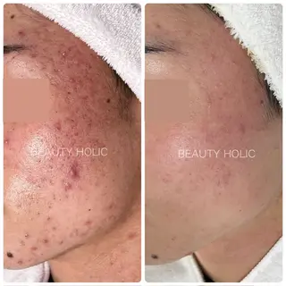 ビューティーホリック 東金店のエステ・リラクイメージ