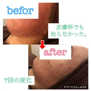 ミディアム カラー パーマ ヘアアレンジ メンズ キッズ ネイル マツエク・マツパ 金の糸脱毛 産毛ケア専門のエステ・リラクイメージ