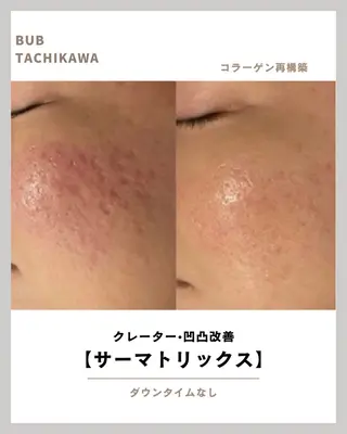 メンズ 【BUB立川】 ゆかのエステ・リラクイメージ
