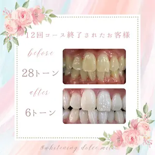 セルフホワイトニング Dolce八王子店のその他イメージ