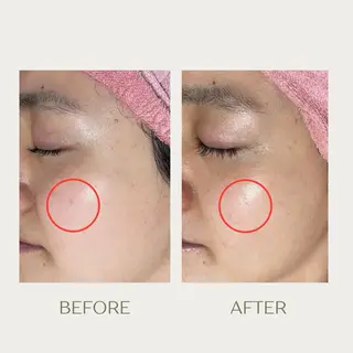 ピーリングケア 🤍moekoのその他イメージ