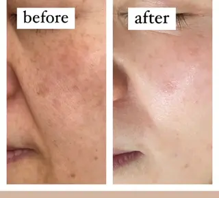 ハーブピーリング　美肌サロン　health and beauty maki所属・ハーブピーリング 美肌サロン　makiのエステ・リラクイメージ